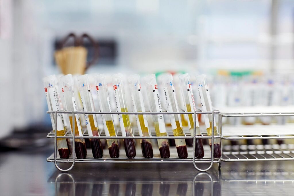 Close-up of medical samples on desk at laboratory